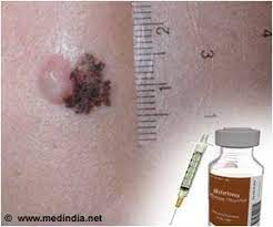 There they help to destroy toxins and infectious materials. No Need For Extensive Lymph Node Surgery In Some Patients With Melanoma