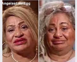 Ted needs a beautiful E.R Lady Dr to transfer to the hospital..