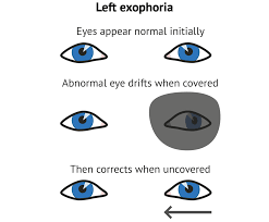 Image result for Cover Test