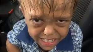 Mother shares video of distraught son, 9, bullied over his dwarfism | World  News | Sky News