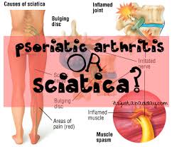 Pin On It S Just A Bad Day Not A Bad Life Spoonie Autoimmune Disease Community Preparing an action plan for rheumatoid arthritis (ra) flares can help you manage symptoms like joint pain and stiffness.