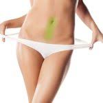 Gently pull the wax in the opposite direction from the hair growth. Anal Laser Hair Removal Package Vs Medspa In Toronto
