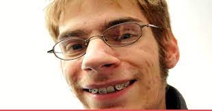 10 Brutally Honest Tips To Deal With Being Ugly