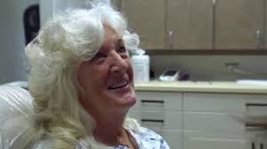 Veneer Before and After