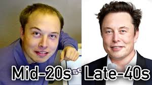 New elon topical hair loss treatments work to increase the flow of nutrients and oxygen, while oral support provides the nutrition necessary for healthy hair restoration. Elon Musk Hair Transplant Exposed Youtube