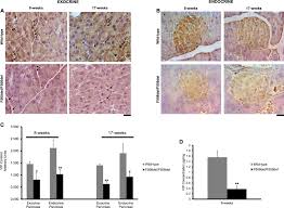 Cystic fibrosis | care guidelines for nutrition management. Vip Reduction In The Pancreas Of F508del Homozygous Cf Mice And Early Signs Of Cystic Fibrosis Related Diabetes Cfrd Journal Of Cystic Fibrosis
