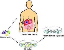 Tumor Organoids and Personalized Cancer Therapy: The Future of ...