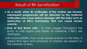 Image result for Rh Sensitization
