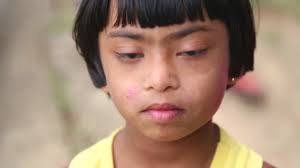Young Sri Lankan girl with down syndrome in Ella — Stock Video ©  paulprescott #57895463