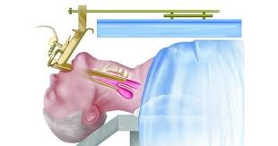Check spelling or type a new query. Zenkers Diverticulum Www Medicoapps Org