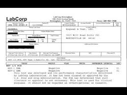 If you think you've been exposed to the pcr tests also allow for testing much later into an outbreak than viral culture testing, which can often result in a false negative result when the herpes. Genital Herpes Cure New Test Results Herpes Cure Eradication Www Theundergroundcure Com Youtube