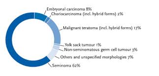 There may be somethingwrong if: Krebs Testicular Cancer