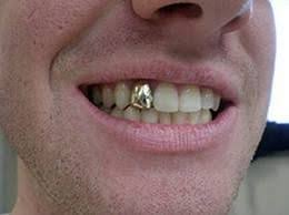 Pin On Crowns Lake Worth Florida