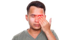 Sindrom Sjogren: Autoimun pada Kelenjar Air Mata dan Liur