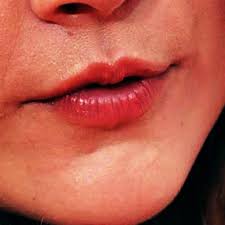 Duck lips commonly popular in women using for selfie by pressing. People Against Natalie Dormer Doing Duckface In The Photos Home Facebook