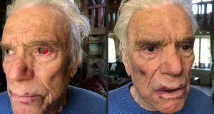 My grandfather refused to be taken away. French Tycoon Bernard Tapie Tied Up And Beaten In Paris Burglary