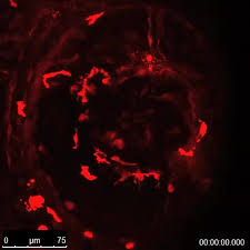Youtube movies and shows are part of youtube's gigantic streaming network. The Cationic Amino Acid Exporter Slc7a7 Is Induced And Vital In Zebrafish Tissue Macrophages With Sustained Efferocytic Activity Journal Of Cell Science The Company Of Biologists