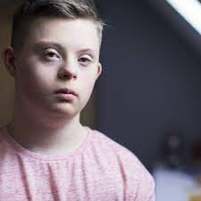 Cognitive impairment, problems with thinking and learning, is common in people with down syndrome and usually ranges from mild to moderate. My Son 14 Has Down Syndrome And Is Hugging People Inappropriately