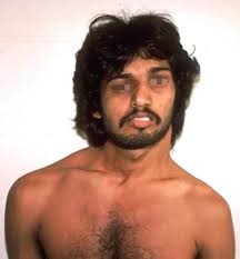 Sternomastoid Tumour of Infancy and Congenital Muscular Torticollis