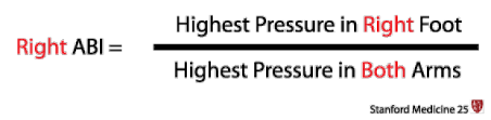 Abi >1.3 is a false negative caused by noncompressible arteries. Ankle Brachial Index Stanford Medicine 25 Stanford Medicine