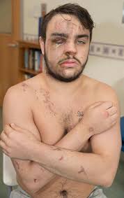 Horrified reveller Steven Hose tells how the skin