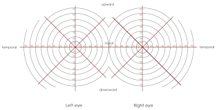 Military Disability Ratings For Eye Conditions