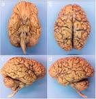 Image of Human brain