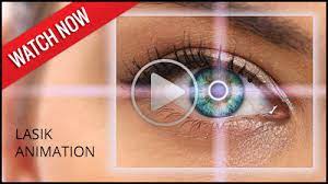 We, at north shore eye care, are dedicated to serving our community and we strive to provide you with the best in eye care and eye wear. Northshore Eye Care Lasik