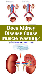 Pin On Kidney Disease Diet