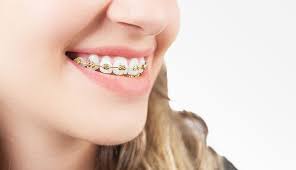 When you are thinking about what color braces should get, you can also think about your skin tone. Types Of Braces Mcmillian Orthodontics Greensboro Nc