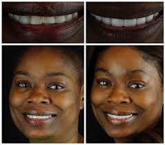 Meet Dr Tyler Broadbent