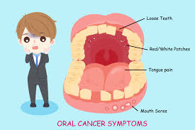 You might not know you have a cancerous or precancerous lesion until you visit your dentist for your regular checkup. à¤® à¤¹ à¤• à¤• à¤¸à¤° à¤• à¤ª à¤°à¤• à¤° à¤• à¤œ à¤¨à¤¨ à¤• à¤¸ à¤¥ à¤œ à¤¨ à¤²à¤• à¤·à¤£ à¤¬à¤š à¤µ à¤¹ à¤² à¤¸ à¤µ à¤¸ à¤¥ à¤¯
