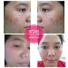 Just check what you want then you will see reasonable price and great offers. Keistimewaan Vsl Beauty Care Pasir Gudang Johor Facebook