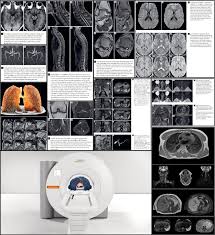 Trouver les numéros de téléphone et adresses des professionnels de votre département ou de votre ville prestations : Philippe Spring Trm Repondant Secteur Irm Hopital Riviera Chablais Hrc Vaud Valais Linkedin