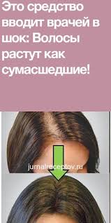шум в ушах и голове лечение в домашних условиях Eto Sredstvo Vvodit Vrachej V Shok Volosy Rastut Kak Sumasshedshie Beauty Recipes Hair Natural Remedies For Heartburn Natural Remedy For Hemorrhoids