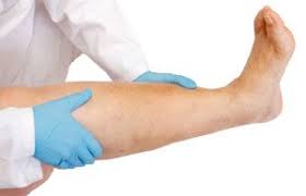 Symptoms of a usual blood clot include leg swelling, calf muscle pain, shortness of breath, pain when breathing in deeply, or coughing up blood, dr thomas said. Can Excess Sleep Cause A Deep Vein Thrombosis Blood Clot Scary Symptoms