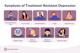 Image result for Refractory Depression Management