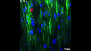 Global and local tension measurements in biomimetic skeletal muscle tissues  reveals early mechanical homeostasis