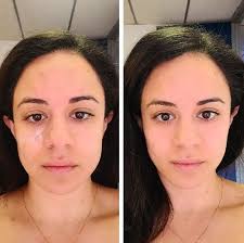 Tabitha Abraham, MSN, FNP-C (@tabitha.aesthetic.injector) • Instagram  photos and videos