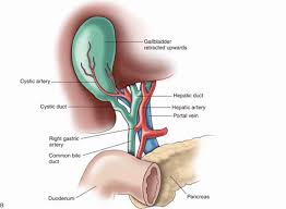 Primary biliary cholangitis causes fatigue. Biliary Ultrasound Core Em