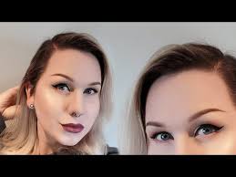 My Hair Transplant Surgery *2 year update*