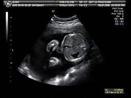See more ideas about baby ultrasound, baby ultrasound pictures, ultrasound pictures. Baby Ultrasound Time Lapse Stock Footage Video 100 Royalty Free 562465 Shutterstock