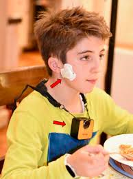 Craniofacial research