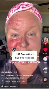 @Angie Batis and @Mikayla Nogueira I loved your #ByeByeRedness videos and  wanted to share mine too! ❤️ (marking AD as I work with #ITCosmetics  ongoing) #LearnwithRose #ITRose #Redness #Rosacea ...