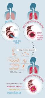 La preuve sociale, ou social proof en anglais, est une composante très importante dans la j'espère vous avoir donné la réponse à la fameuse question comment savoir si on plait à une fille ? Comprendre L Asthme De L Adulte Ameli Fr Assure