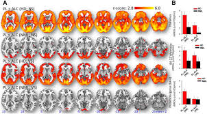 Al isra ayat 32 al ikhsan warehouse sale 2019 al ikhsan sale 2018 al awfar bank islam al masjid al nabawi al fatihah untuk arwah alam flora shah alam alamat jpn pulau pinang. Alcohol Decreases Baseline Brain Glucose Metabolism More In Heavy Drinkers Than Controls But Has No Effect On Stimulation Induced Metabolic Increases Journal Of Neuroscience