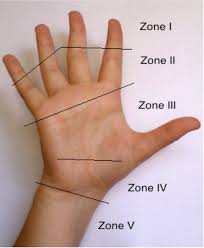 Isolation of each digit index f: An Overview Of The Management Of Flexor Tendon Injuries