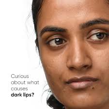 Are you curious to know what causes dark lips & how to treat & prevent lip  pigmentation? We have a solution! Our L-Ascorbic Acid 08% Lip Treatment  Balm is formulated to treat