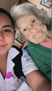 En paz descanse nuestra quería Mary Cardenas, una de las últimas pacientes  valientes que sobrevivieron a la enfermedad de Hansen. Hospital Pedro López  Ixtapaluca