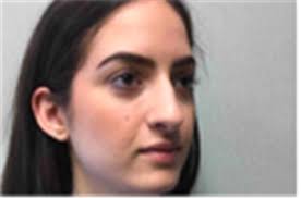 Rhinoplasty Before and After Photos by Mariam Awada, MD, FACS; Southfield,  MI